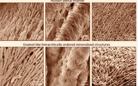 研究人員開(kāi)發(fā)出可以使牙釉質(zhì)再生的新型礦化材料