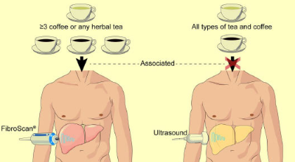 食用咖啡 涼茶可預(yù)防肝纖維化