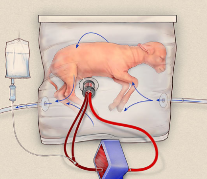 新的類似子宮的設(shè)備可能會改變極早嬰兒的護理