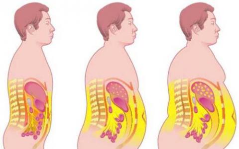 腰部脂肪的堆積比肥胖引起的并發(fā)癥更為嚴(yán)重