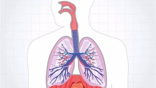 肺康復(fù)可以改善肺部疾病患者的健康