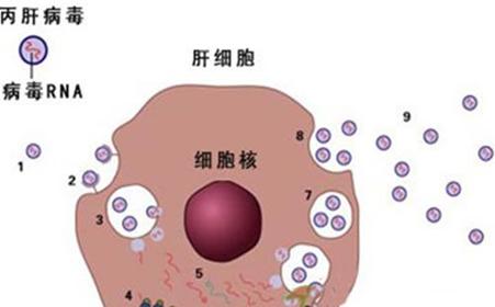 丙肝替代性肝硬化中無需避免他汀類藥物