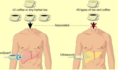 食用咖啡 涼茶可預防肝纖維化