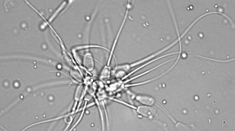 生物學家根據(jù)新陳代謝檢查精子質量