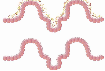 研究人員開發(fā)出改變腸道菌群 為炎癥性疾病接種疫苗的方法
