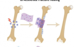 骨繃帶吸收修復(fù)性生化物質(zhì)以加速修復(fù)