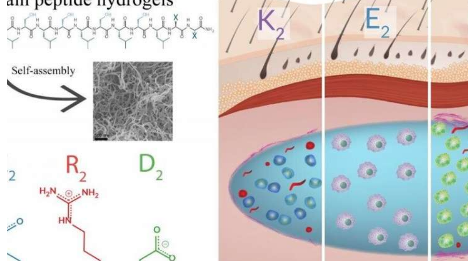 水凝膠可控制炎癥以幫助治愈