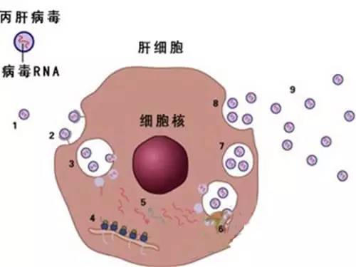 城市急診室發(fā)現(xiàn)丙型肝炎感染率很高