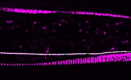 控制分子膠可保護腦細胞之間的連接