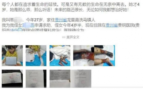 女童被虐待燙傷事件怎么回事？貴州龍里縣虐待女童事件起因經(jīng)過結果全過程詳情始末梳理